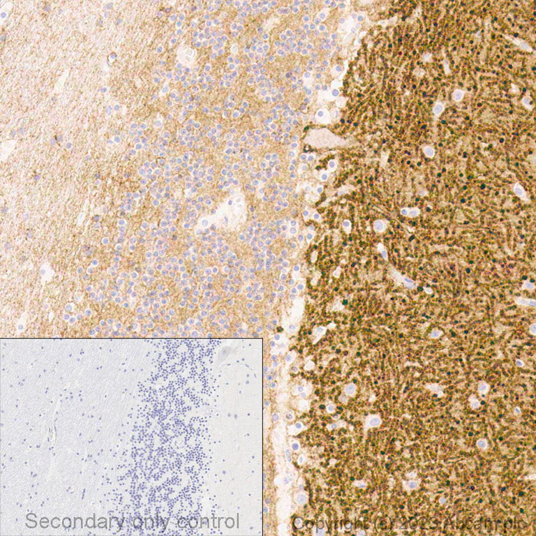 Immunohistochemistry (Formalin/PFA-fixed paraffin-embedded sections) - Anti-NCAM1 antibody [EPR2566] - BSA and Azide free (AB214436)