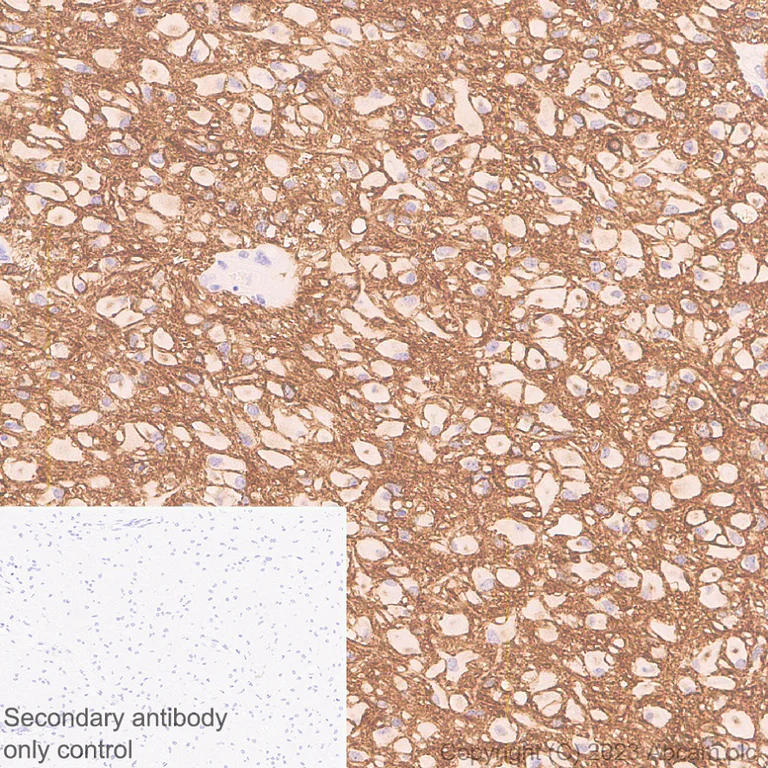 Immunohistochemistry (Formalin/PFA-fixed paraffin-embedded sections) - Anti-NCAM1 antibody [EPR26939-108] (AB313779)