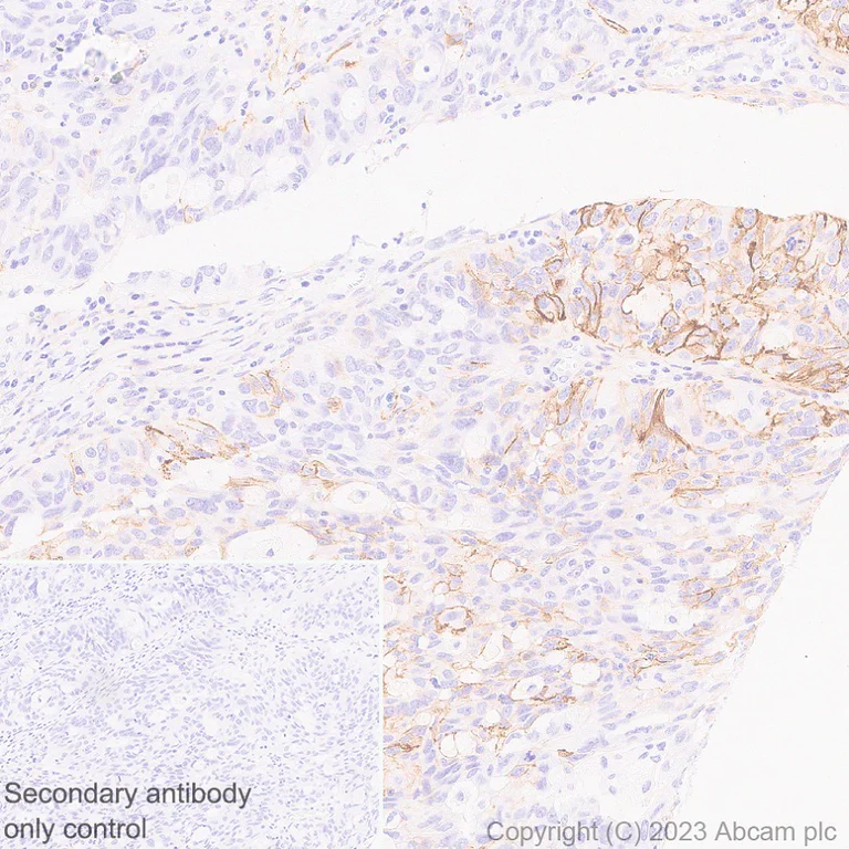 Immunohistochemistry (Formalin/PFA-fixed paraffin-embedded sections) - Anti-NCAM1 antibody [EPR26939-108] (AB313779)
