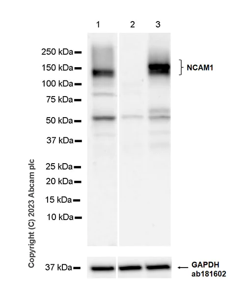Western blot - Anti-NCAM1 antibody [EPR26939-108] (AB313779)