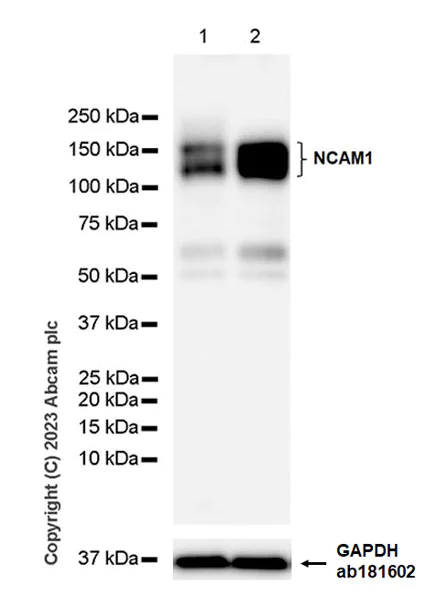 Western blot - Anti-NCAM1 antibody [EPR26939-108] (AB313779)