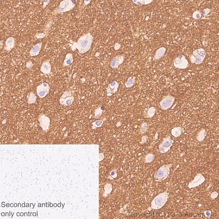 Immunohistochemistry (Formalin/PFA-fixed paraffin-embedded sections) - Anti-NCAM1 antibody [EPR26939-108] - BSA and Azide free (AB313780)