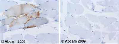 Immunohistochemistry (Formalin/PFA-fixed paraffin-embedded sections) - Anti-NCAM1 antibody [ERIC-1] (AB6123)