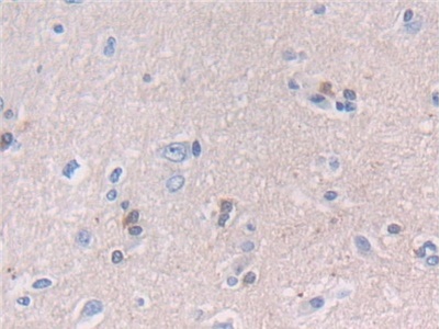 Immunohistochemistry (Formalin/PFA-fixed paraffin-embedded sections) - Anti-NCAM2 antibody (AB232923), expandable thumbnail