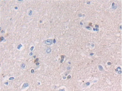 Immunohistochemistry (Formalin/PFA-fixed paraffin-embedded sections) - Anti-NCAM2 antibody (AB232923)