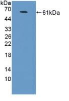 Western blot - Anti-NCAM2 antibody (AB232923), expandable thumbnail