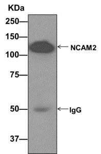 Immunoprecipitation - Anti-NCAM2 antibody [EPR12815(B)] (AB173297)