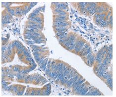 Immunohistochemistry (Formalin/PFA-fixed paraffin-embedded sections) - Anti-NCAPD2 antibody - C-terminal (AB198019)
