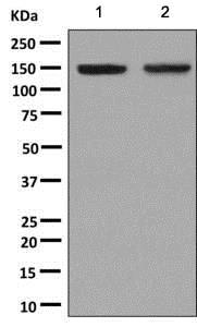 Western blot - Anti-NCAPD2 antibody [EPR9220] (AB137075)