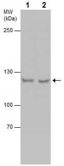 Western blot - Anti-NCAPG antibody (AB226805)