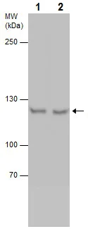 Western blot - Anti-NCAPG antibody (AB226805)