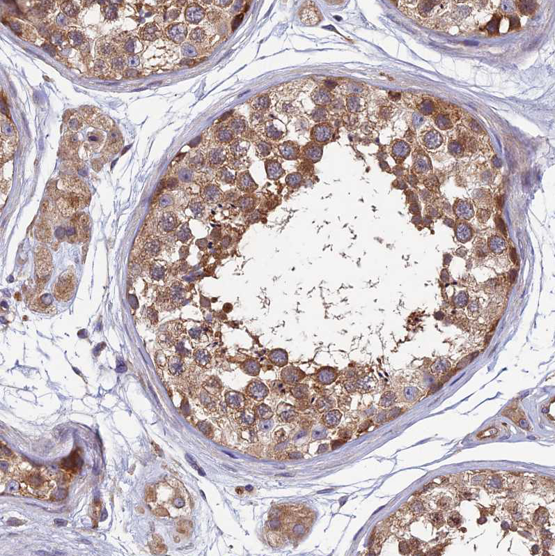 Immunohistochemistry (Formalin/PFA-fixed paraffin-embedded sections) - Anti-NCAPG antibody (AB251864), expandable thumbnail