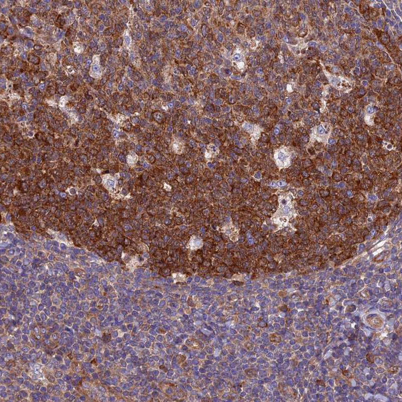 Immunohistochemistry (Formalin/PFA-fixed paraffin-embedded sections) - Anti-NCAPG antibody (AB251864), expandable thumbnail