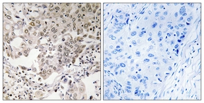 Immunohistochemistry (Formalin/PFA-fixed paraffin-embedded sections) - Anti-NCAPG2 antibody (AB110882)