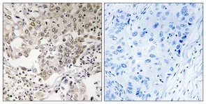 Immunohistochemistry (Formalin/PFA-fixed paraffin-embedded sections) - Anti-NCAPG2 antibody (AB110882)