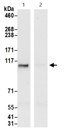 Immunoprecipitation - Anti-NCAPG2 antibody (AB70350), expandable thumbnail