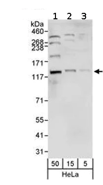Western blot - Anti-NCAPG2 antibody (AB70350)