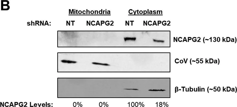 Western blot - Anti-NCAPG2 antibody (AB70350)