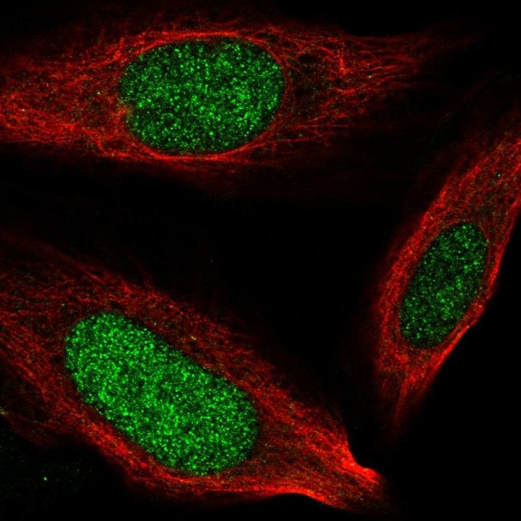 Immunocytochemistry/ Immunofluorescence - Anti-NCAPH2 antibody (AB221722)