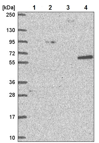 Western blot - Anti-NCAPH2 antibody (AB221722)