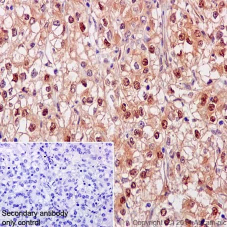 Immunohistochemistry (Formalin/PFA-fixed paraffin-embedded sections) - Anti-NCAPH2 antibody [EPR17170] (AB200659)