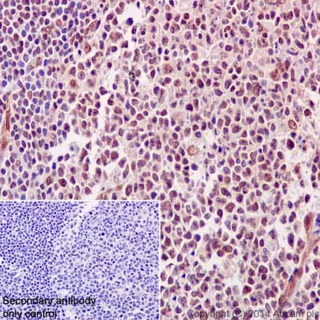 Immunohistochemistry (Formalin/PFA-fixed paraffin-embedded sections) - Anti-NCAPH2 antibody [EPR17170] (AB200659)