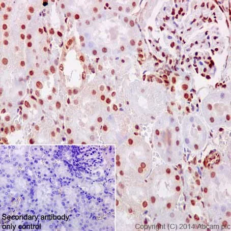 Immunohistochemistry (Formalin/PFA-fixed paraffin-embedded sections) - Anti-NCAPH2 antibody [EPR17170] (AB200659)