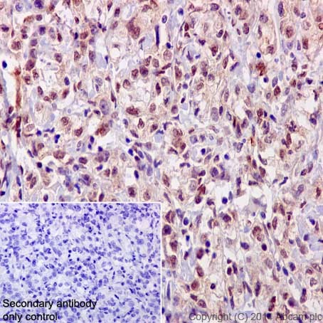 Immunohistochemistry (Formalin/PFA-fixed paraffin-embedded sections) - Anti-NCAPH2 antibody [EPR17170] (AB200659)