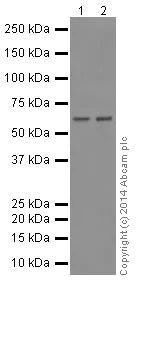 Western blot - Anti-NCAPH2 antibody [EPR17170] (AB200659)