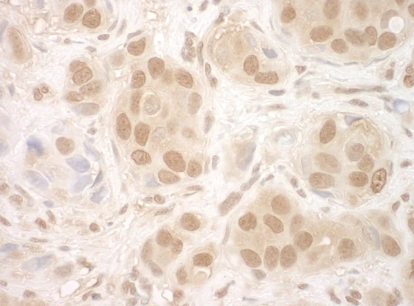 Immunohistochemistry (Formalin/PFA-fixed paraffin-embedded sections) - Anti-NCBP2 antibody (AB91556)