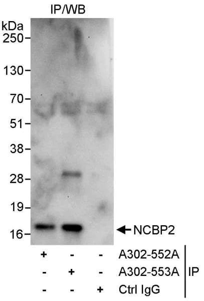 Immunoprecipitation - Anti-NCBP2 antibody (AB91556)