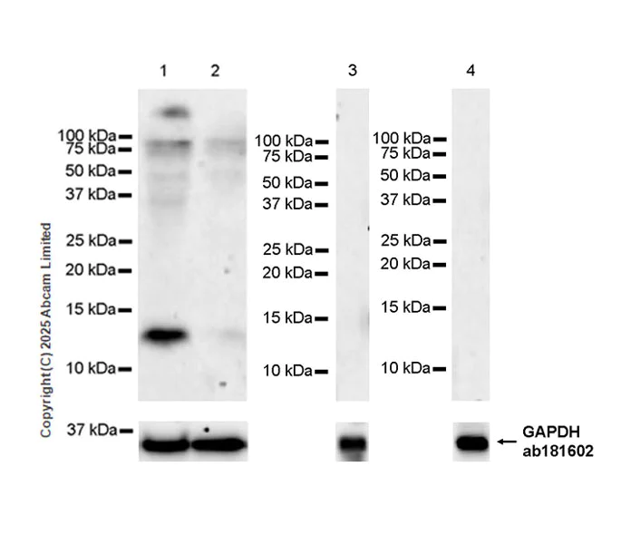 Western blot - Anti-NCBP2AS2 antibody [EPR28845-5] (AB323482)
