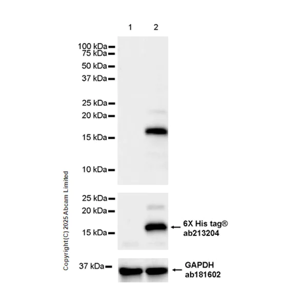 Western blot - Anti-NCBP2AS2 antibody [EPR28845-5] (AB323482)