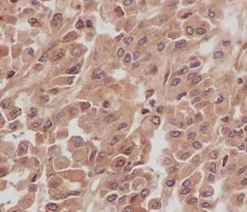 Immunohistochemistry (Formalin/PFA-fixed paraffin-embedded sections) - Anti-NCE2/UBE2F antibody [EPR12932] (AB185234)