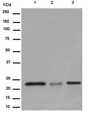 Western blot - Anti-NCE2/UBE2F antibody [EPR12932] (AB185234)