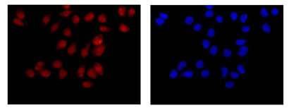 Immunocytochemistry/ Immunofluorescence - Anti-NCE2/UBE2F antibody [EPR12932] - BSA and Azide free (AB240291), expandable thumbnail