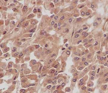 Immunohistochemistry (Formalin/PFA-fixed paraffin-embedded sections) - Anti-NCE2/UBE2F antibody [EPR12932] - BSA and Azide free (AB240291), expandable thumbnail