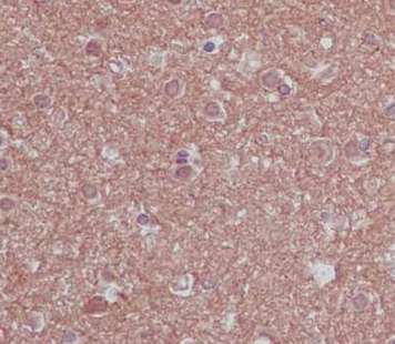 Immunohistochemistry (Formalin/PFA-fixed paraffin-embedded sections) - Anti-NCE2/UBE2F antibody [EPR12932] - BSA and Azide free (AB240291), expandable thumbnail