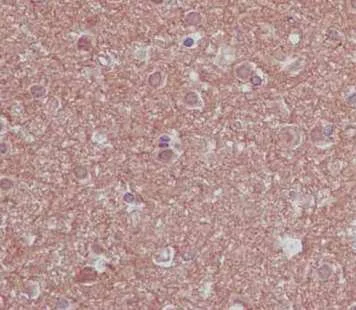 Immunohistochemistry (Formalin/PFA-fixed paraffin-embedded sections) - Anti-NCE2/UBE2F antibody [EPR12932] - BSA and Azide free (AB240291)