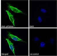 Immunocytochemistry/ Immunofluorescence - Anti-NCF1/p47-phox antibody (AB166930)