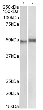 Western blot - Anti-NCF1/p47-phox antibody (AB795)