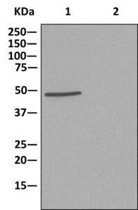 Immunoprecipitation - Anti-NCF1/p47-phox antibody [EPR13134] - BSA and Azide free (AB250099)