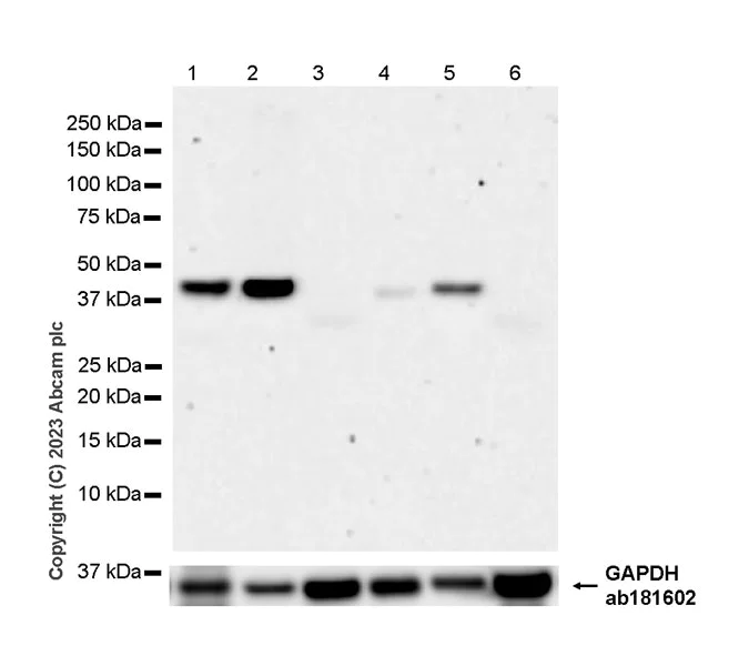 Western blot - Anti-NCF1/p47-phox antibody [EPR27205-231] (AB308256)