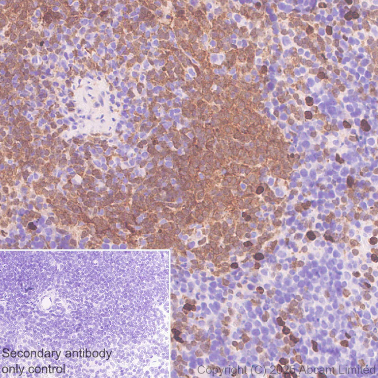 Immunohistochemistry (Formalin/PFA-fixed paraffin-embedded sections) - Anti-NCF1/p47-phox antibody [EPR29939-21] (AB325129)