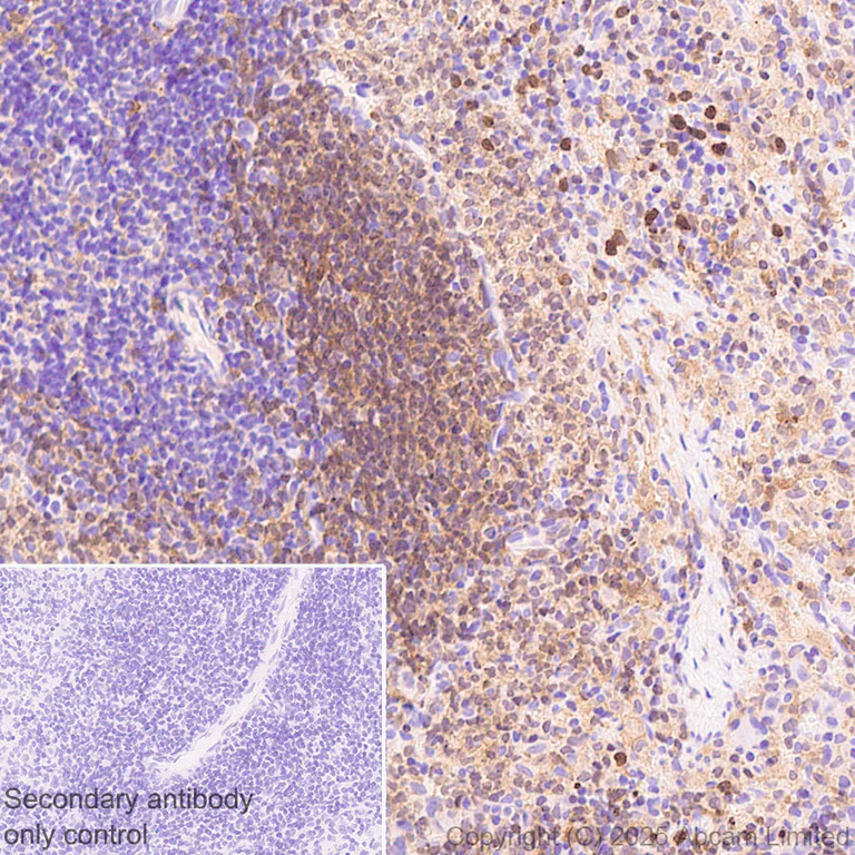 Immunohistochemistry (Formalin/PFA-fixed paraffin-embedded sections) - Anti-NCF1/p47-phox antibody [EPR29939-21] (AB325129)