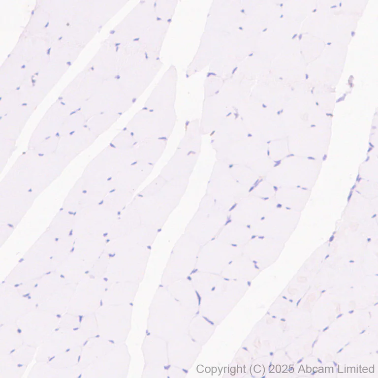 Immunohistochemistry (Formalin/PFA-fixed paraffin-embedded sections) - Anti-NCF1/p47-phox antibody [EPR29939-21] (AB325129)