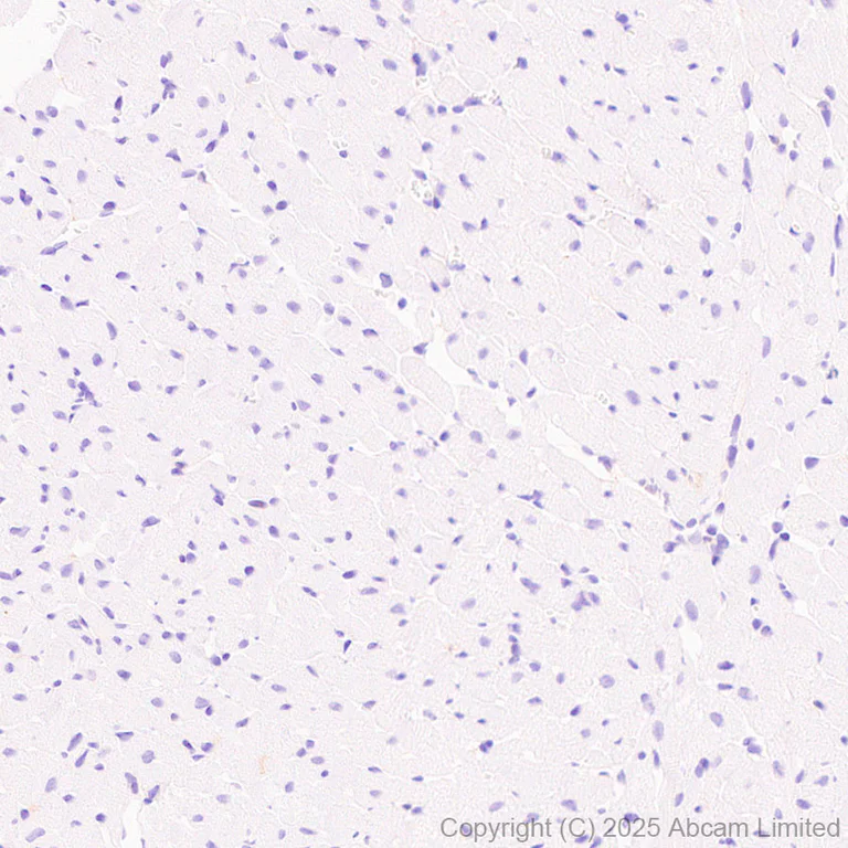 Immunohistochemistry (Formalin/PFA-fixed paraffin-embedded sections) - Anti-NCF1/p47-phox antibody [EPR29939-21] (AB325129)