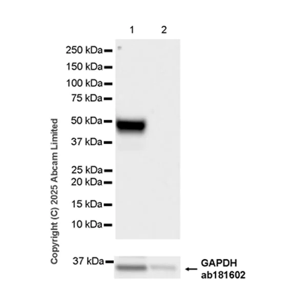 Western blot - Anti-NCF1/p47-phox antibody [EPR29939-21] (AB325129)