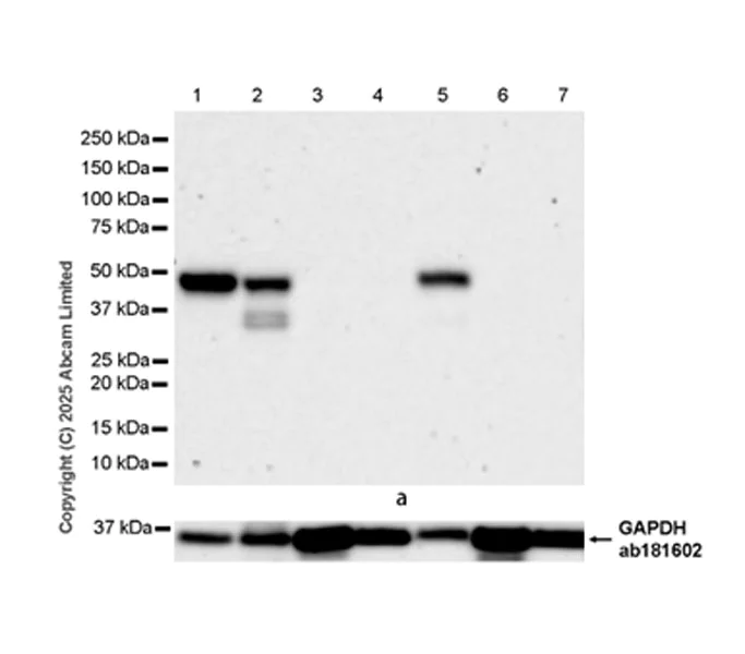Western blot - Anti-NCF1/p47-phox antibody [EPR29939-21] (AB325129)