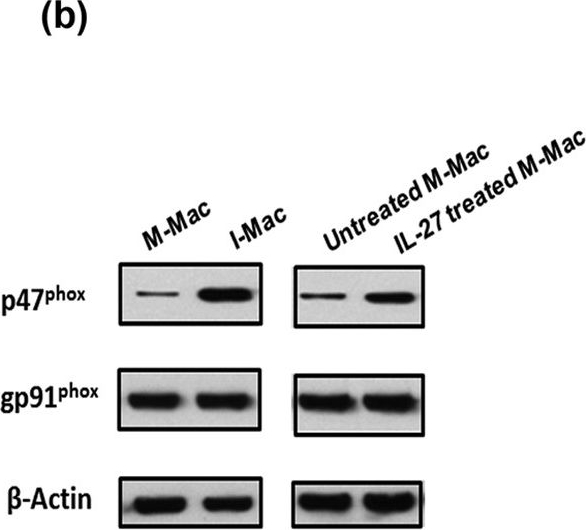 Western blot - Anti-NCF1/p47-phox (phospho S304) antibody (AB63554)